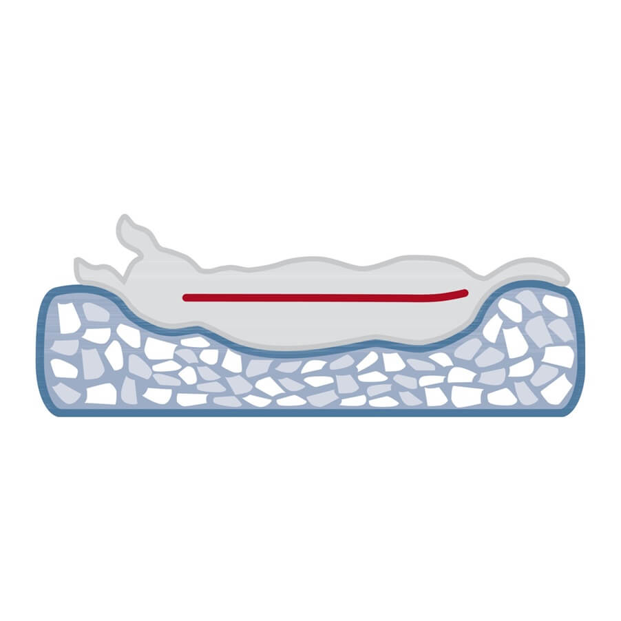 Die Noah Vital Kuschelhöhle bietet deinem Vierbeiner nicht nur einen gemütlichen Rückzugsort, sondern unterstützt dank des orthopädischen Memory-Effekts auch seine Gesundheit.